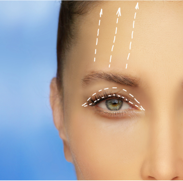 Ptosis paupi&egrave;re qui tombe causes sympt&ocirc;mes traitement et solutions